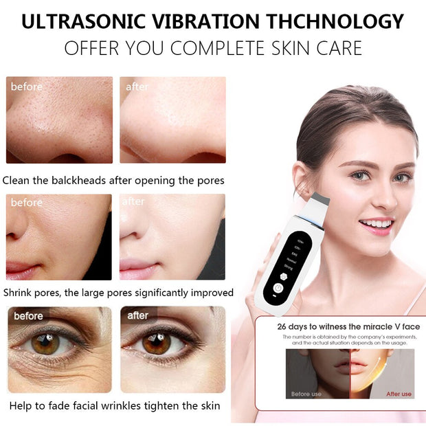Ultrasonic Electric Skin scrubber